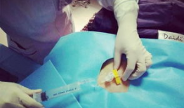 输液港维护视频