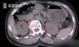 女生拉稀视频,女生拉稀视频引发网友热议